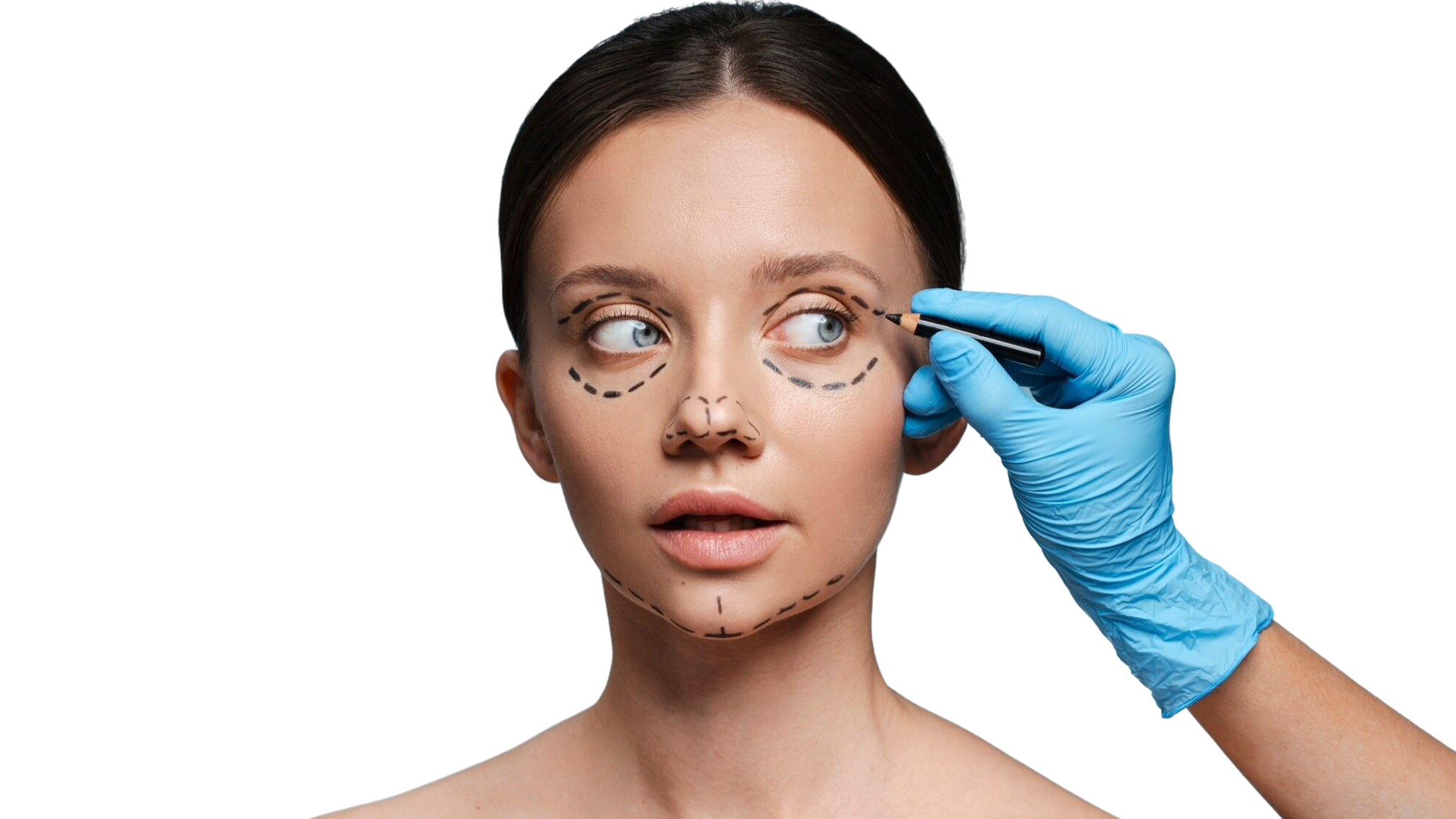 Blepharoplasty